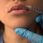 2.REJUVENECIMIENTO LABIOS (1)