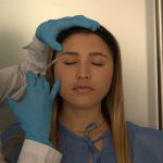 A qué edad se puede aplicar la toxina botulínica