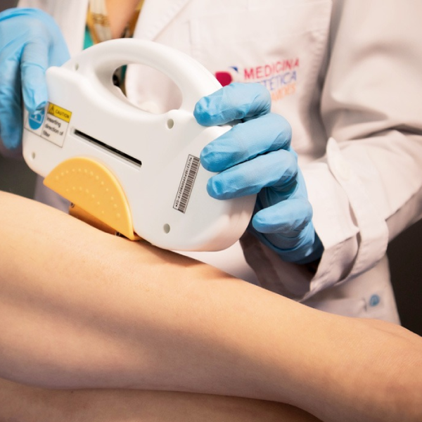 Tratamientos Láser CO2